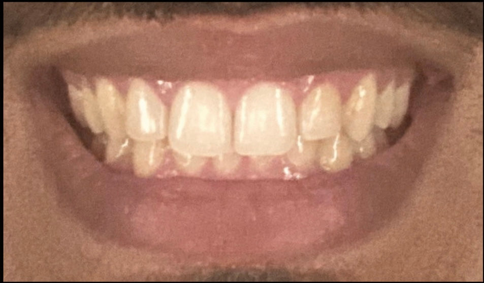 Before